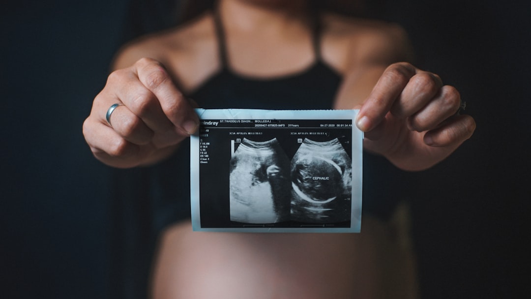 A Comprehensive Guide to IVF: From Preparation to Success
